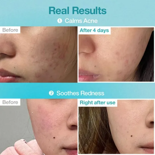 پک ماسک ورقه ای پانتوتنیک و هیالورونیک اسید شماره نامبوزین آبرسان و تسکین دهنده پوست . Sheet Mask Pantothenic Hyaluronic Active Clear Mask