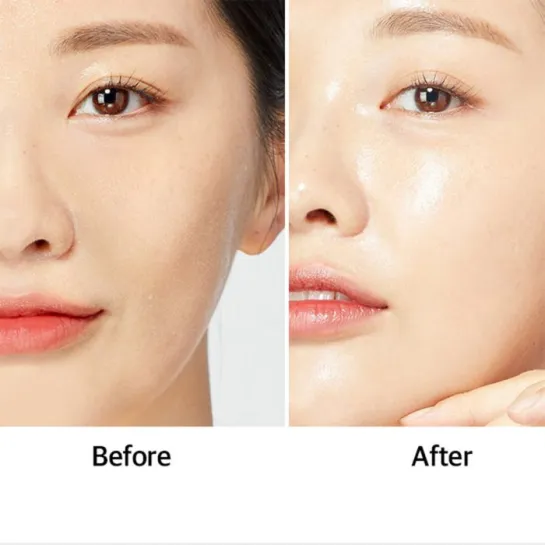 آمپول ضد چروک و روشن کننده پپتاید آکوا اسنس مدی پیل -PEEL Peptide Aqua Essence Lifting Ampoule