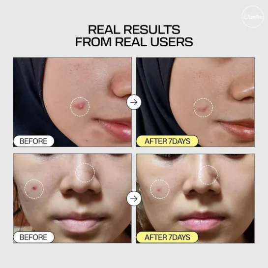 اسنس آبرسان حلزون و پپتید جومیسو +