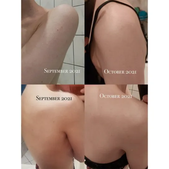 شوینده بدن ضد جوش و آبرسان روزه میراکل سام بای می SOME BY MI AHA BHA PHA days Miracle Acne Body Cleanser