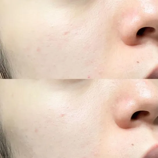 سرم کوچک کننده منافذ سوپر ماچا سام بای می