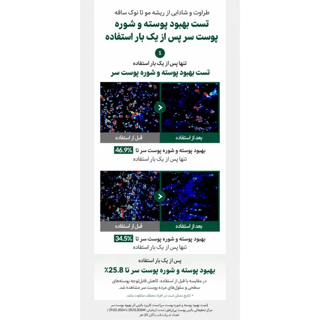 اسنس تقویت کننده مو و کف سر ریپ
