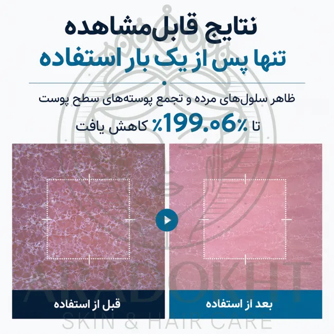 اسپری پیل شات بدن ترانگزامیک اسید دکتر ملاکسین روشن کننده و لایه بردار ملایم
