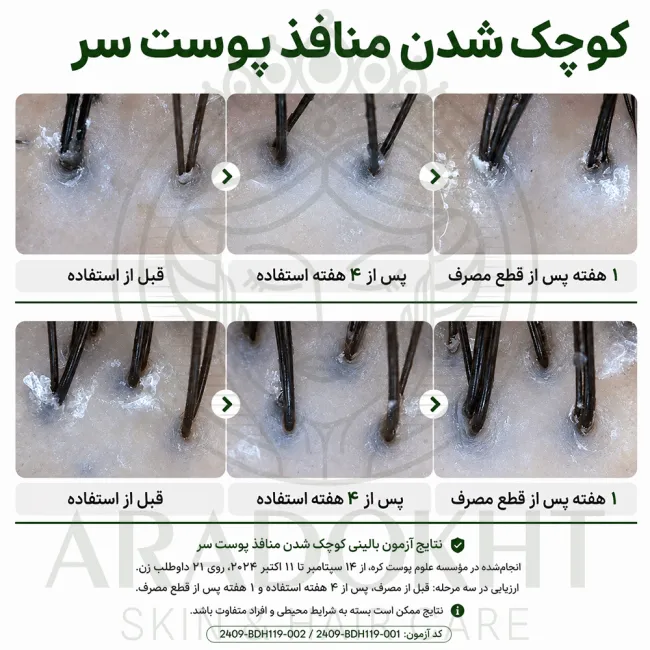 آمپول PDRN مو ریدل شات 100 وی تی کازمتیک احیا، ضد ریزش و تقویت مو