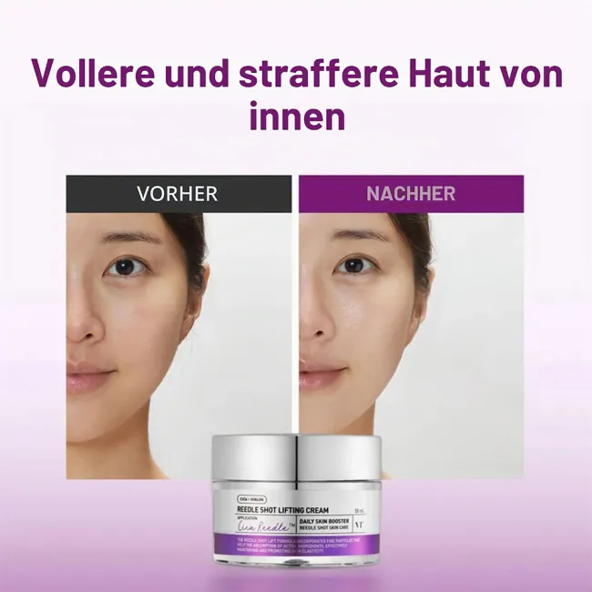 کرم ضد چروک و لیفتینگ وی تی کازمتیک