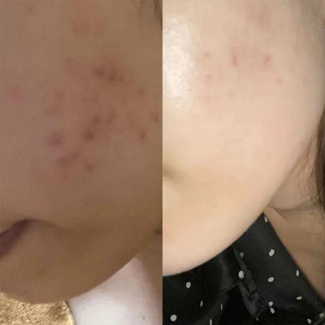 تونر لایه بردار و روشن کننده گلیکولیک اسید 7% اوردینری