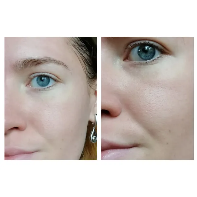 کرم تقویت کننده و تسکین دهنده آنوا