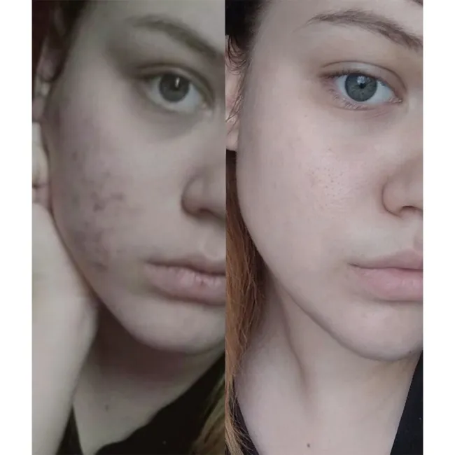 ژل شستشوی پوست چرب و مختلط بایودرما