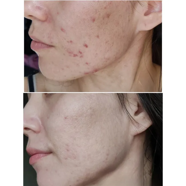 ژل شستشوی پوست چرب و مختلط بایودرما