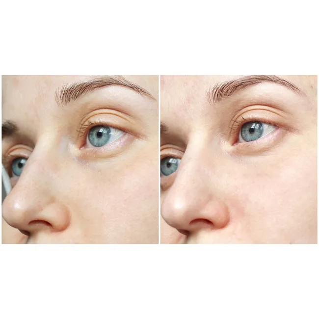 ژل شستشوی پوست چرب و مختلط بایودرما
