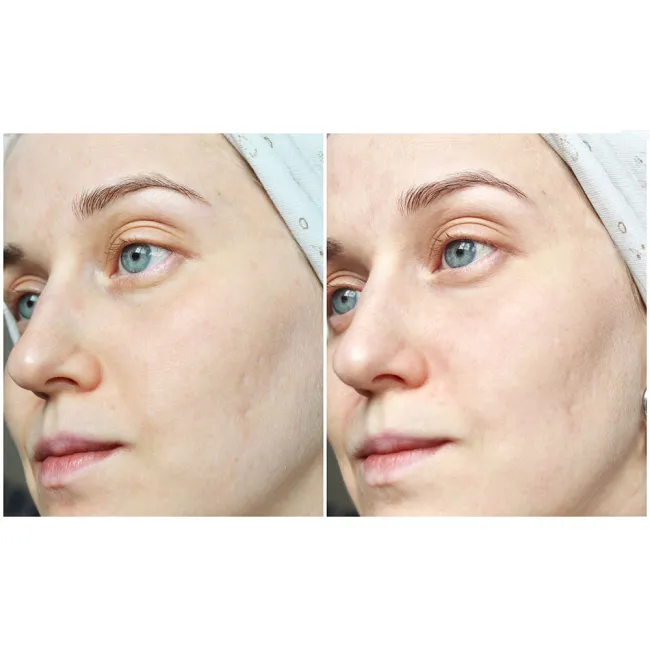 ژل شستشوی پوست چرب و مختلط بایودرما