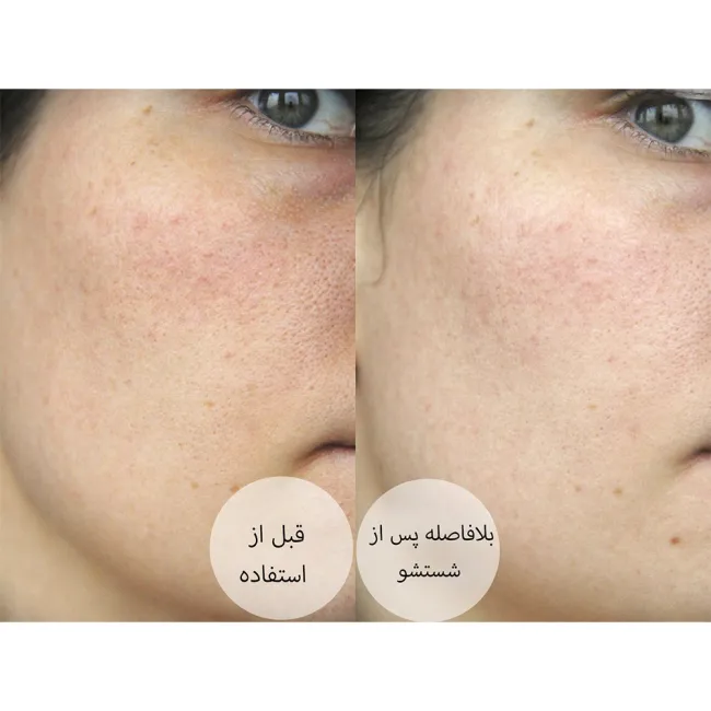 ژل شستشوی نورمادرم ویشی مخصوص پوست چرب و جوش دار