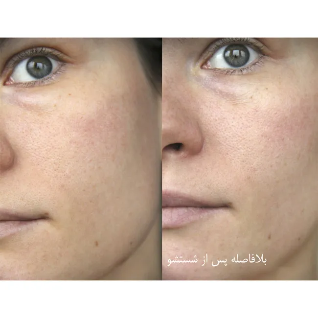 ژل شستشوی نورمادرم ویشی مخصوص پوست چرب و جوش دار