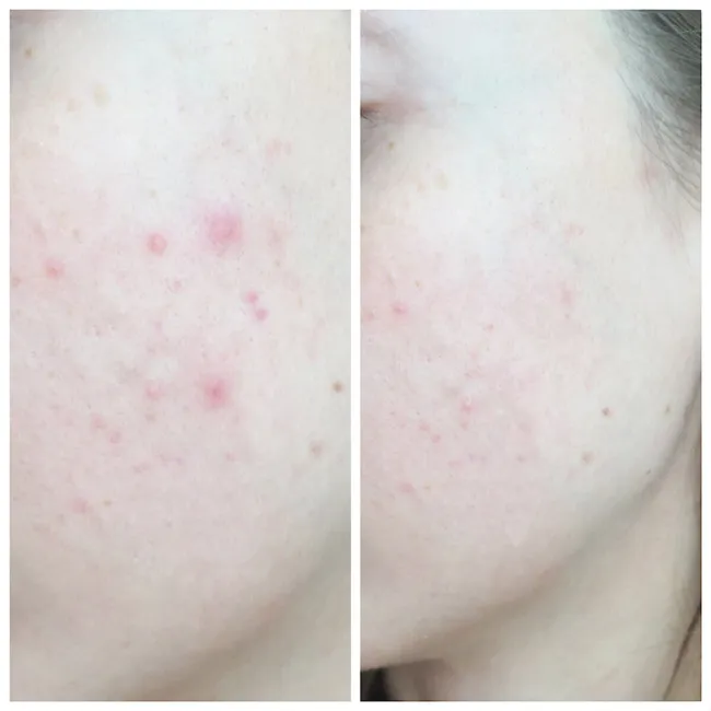کرم ترمیم کننده سیکاپلاست لاروش پوزای