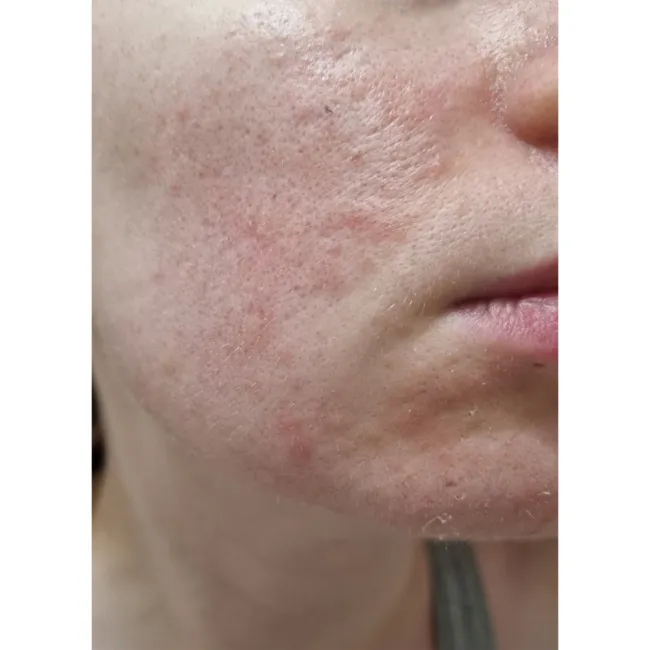 کرم ترمیم کننده سیکاپلاست لاروش پوزای