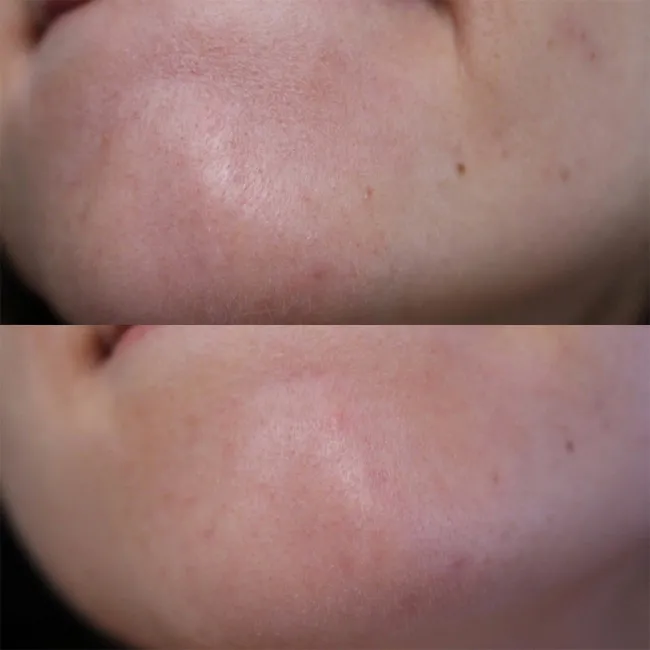 ژل لایه بردار ملایم گود نایت کوزارکس