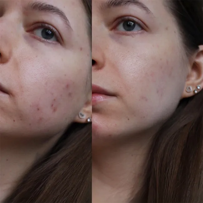 ژل لایه بردار ملایم گود نایت کوزارکس