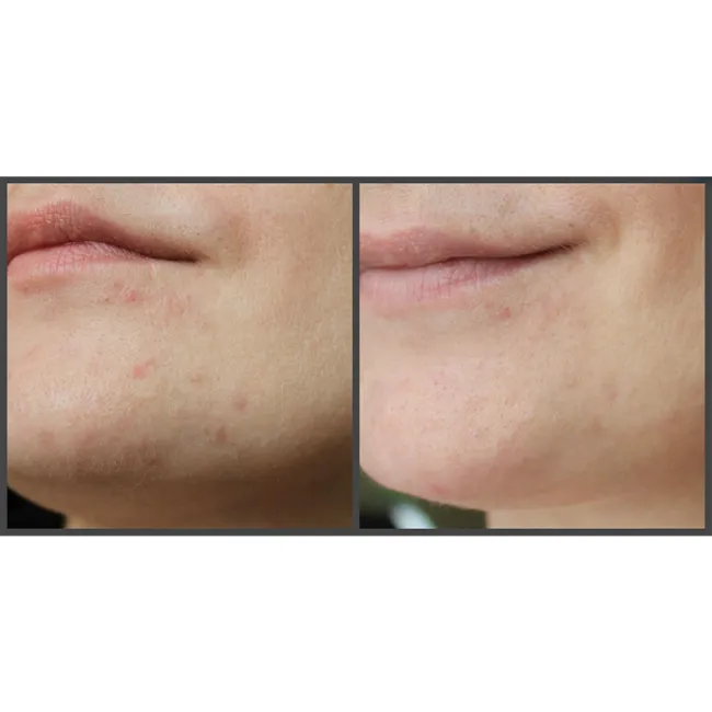 کرم مرطوب کننده و روشن کننده آیم فرام