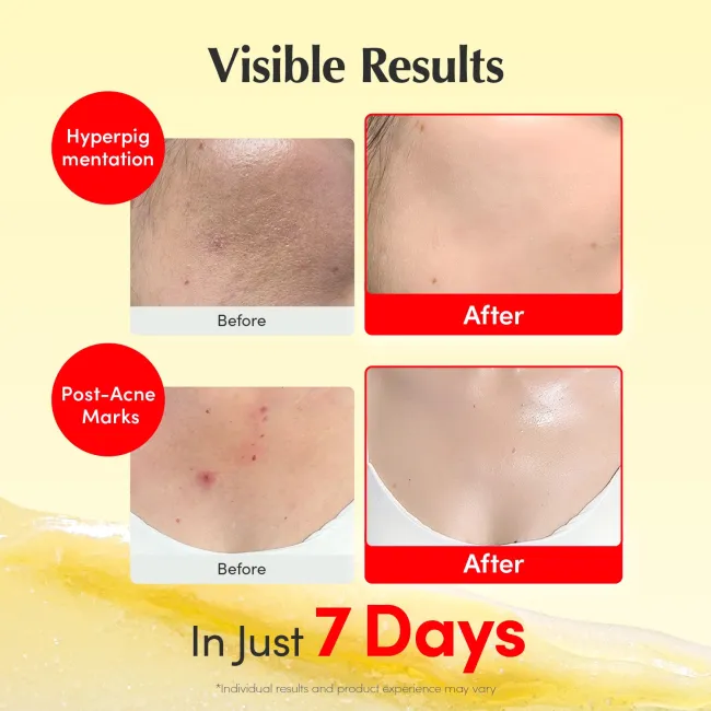 Vitamin illuminating Cream