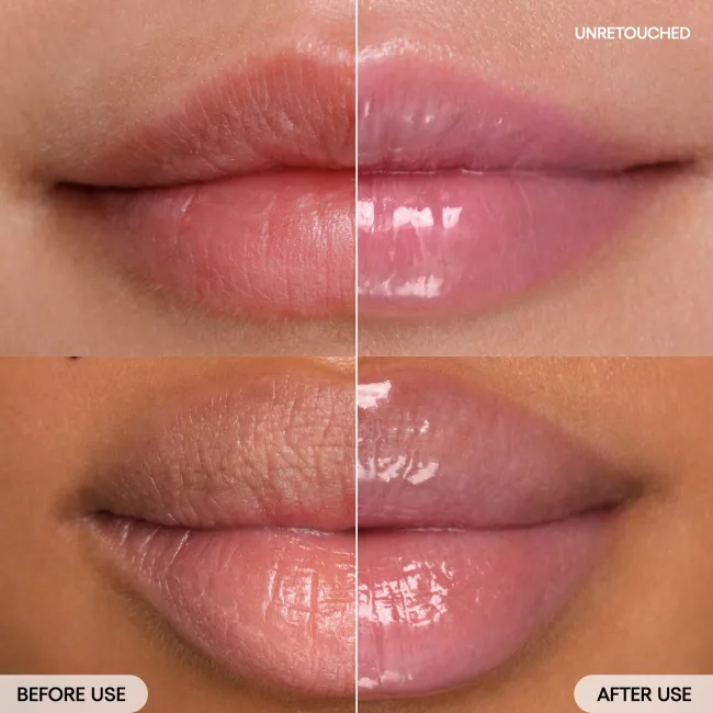 before & after Gummy Bear (Lavender tint) on model