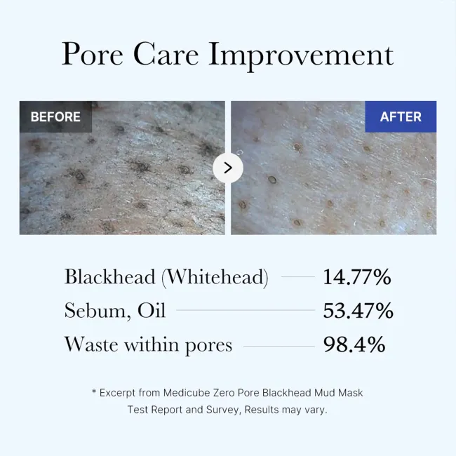 Zero Pore Blackhead Mud Mask - medicube.us