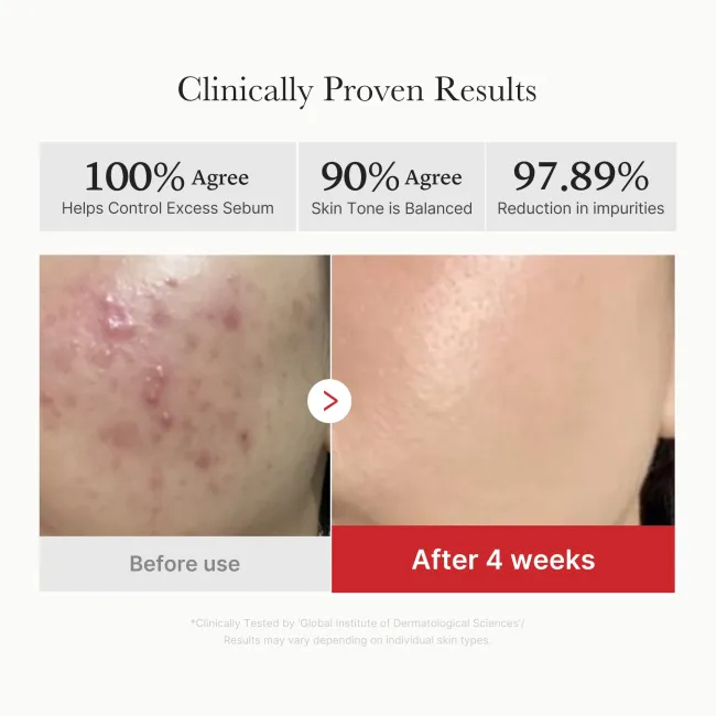 [GIFT] Red Succinic Acid Panthenol Pads - medicube.us