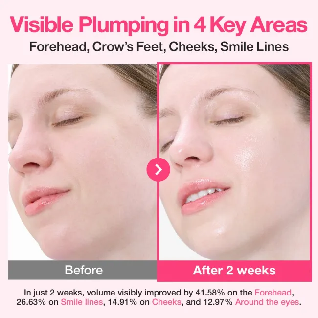 No.2 Rose PDRN Collagen Plumping Serum