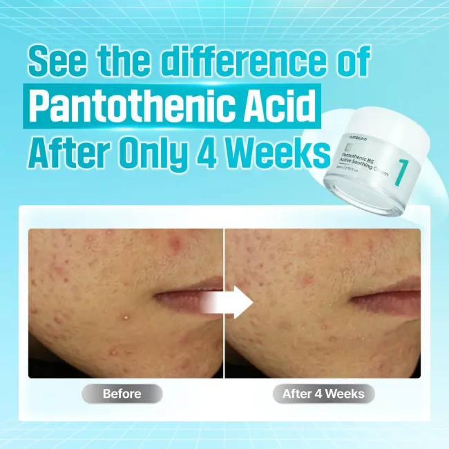 No.1 Pantothenic B5 Active Soothing Cream