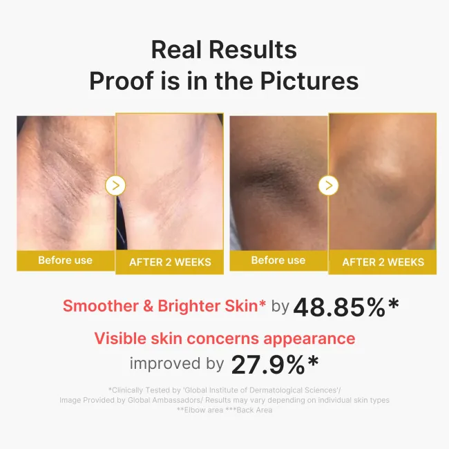 Kojic Acid Turmeric Body Peel Shot - medicube.us