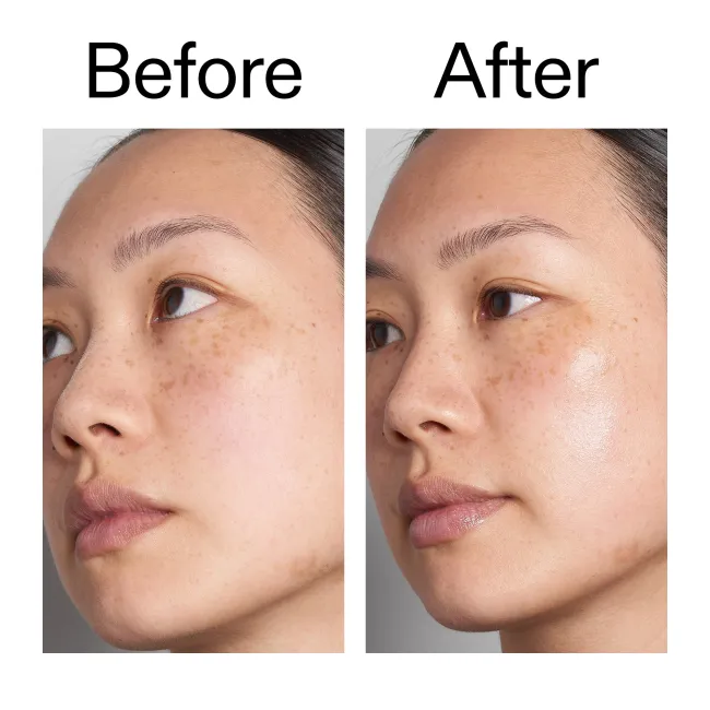  Before and After of customer using Hyaluronic Acid Serum
