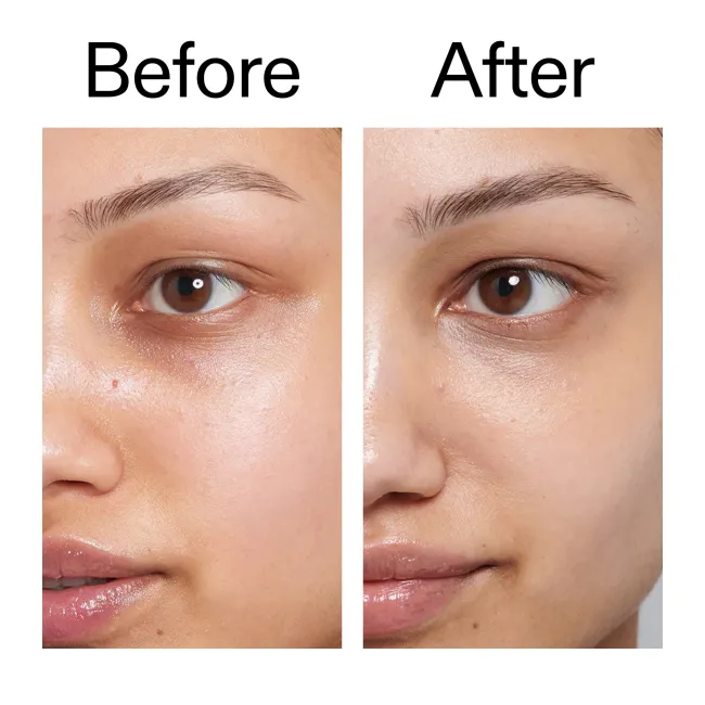 Before and after of customer using Caffeine Eye Cream