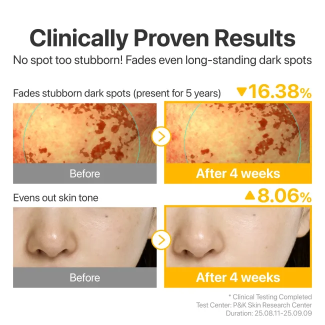 No.5 Glutathione TXA Advanced Dark Spot Ampoule Concentrate
