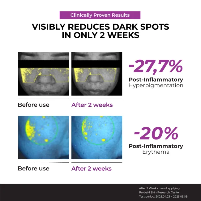 Niacinamide 20% Serum