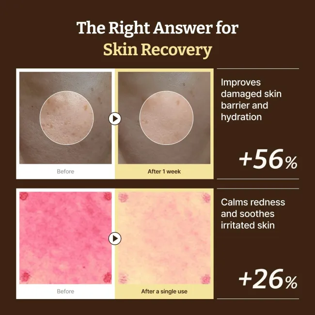 Advanced PDRN Rejuvenating Cream