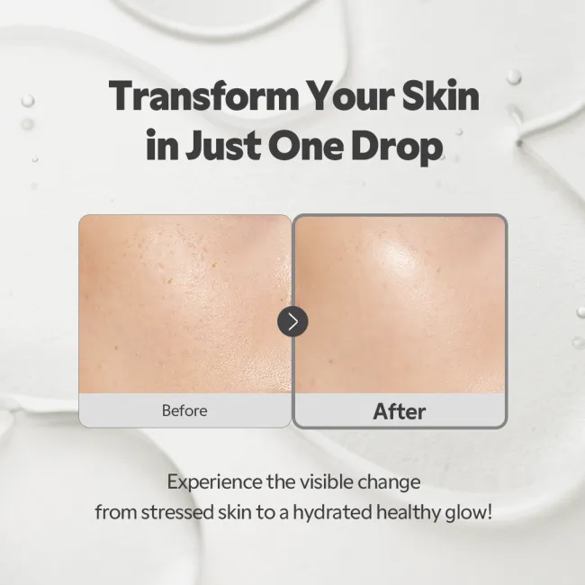 SOS Serum