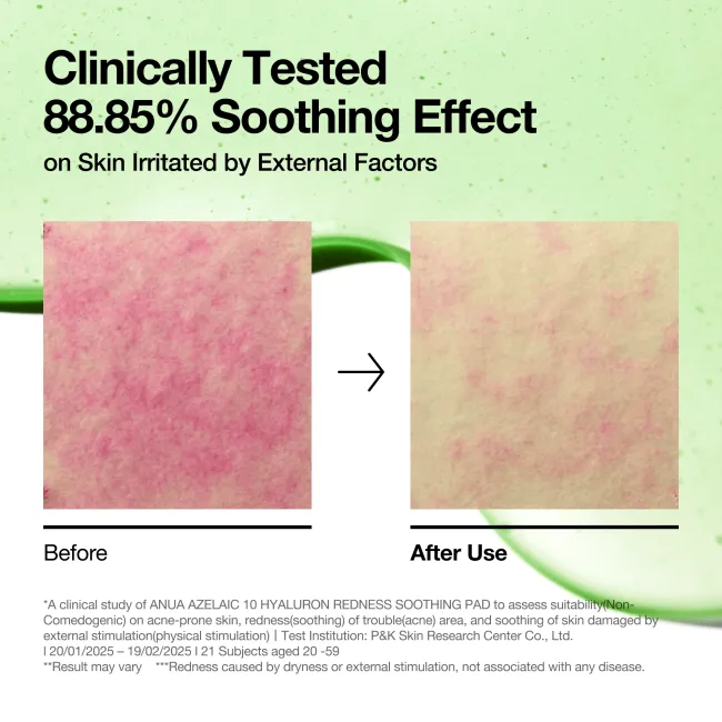 Anua US Toner 90 ea Azelaic 10 Hyaluron Redness Soothing Pad