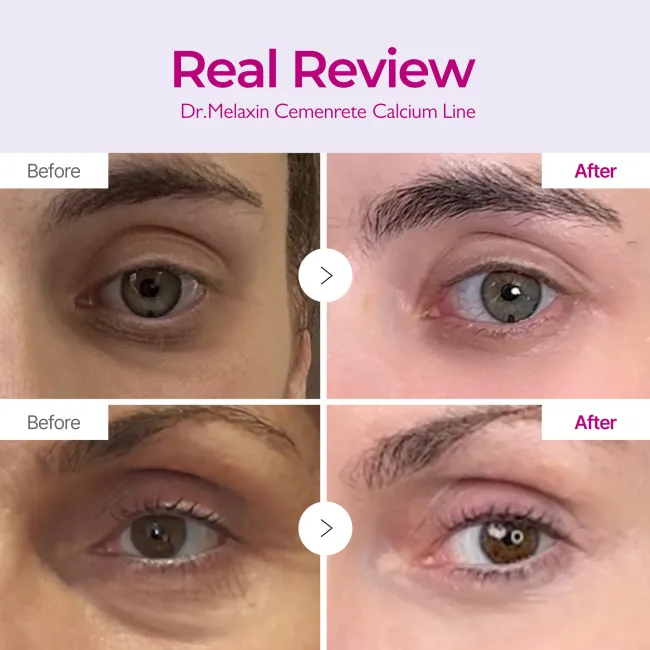 Cemenrete Calcium Intense Ampoule