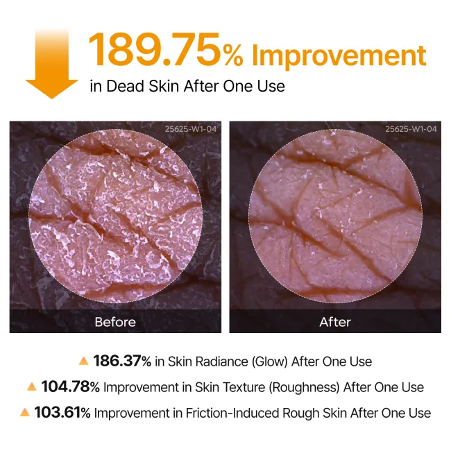 Peel Shot Kojic Acid Turmeric Spray