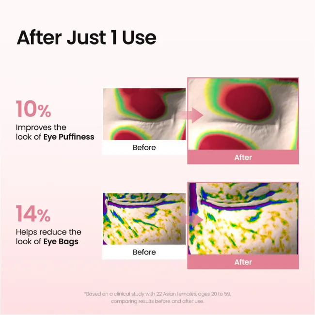 Collagen Peptide Eye Patches