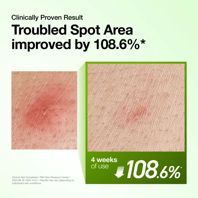 Anua US Ampoule/Serum Azelaic Acid 10 Hyaluron Redness Soothing Serum