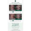 اسنس تقویت کننده مو و کف سر ریپ