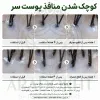 آمپول PDRN مو ریدل شات 100 وی تی کازمتیک احیا، ضد ریزش و تقویت مو
