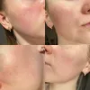 تونر ضد جوش و لایه بردار تیام