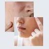 سرم مرطوب کننده و تقویت کننده شیره توس آنوا