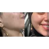 تونر  ضد جوش و آبرسان 30 روزه میراکل سام بای می