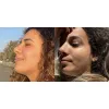 تونر  ضد جوش و آبرسان 30 روزه میراکل سام بای می
