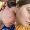 تونر لایه بردار و روشن کننده گلیکولیک اسید 7% اوردینری