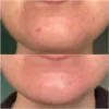 تونر لایه بردار و روشن کننده گلیکولیک اسید 7% اوردینری