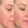 تونر لایه بردار و روشن کننده گلیکولیک اسید 7% اوردینری