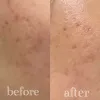 تونر لایه بردار و روشن کننده گلیکولیک اسید 7% اوردینری